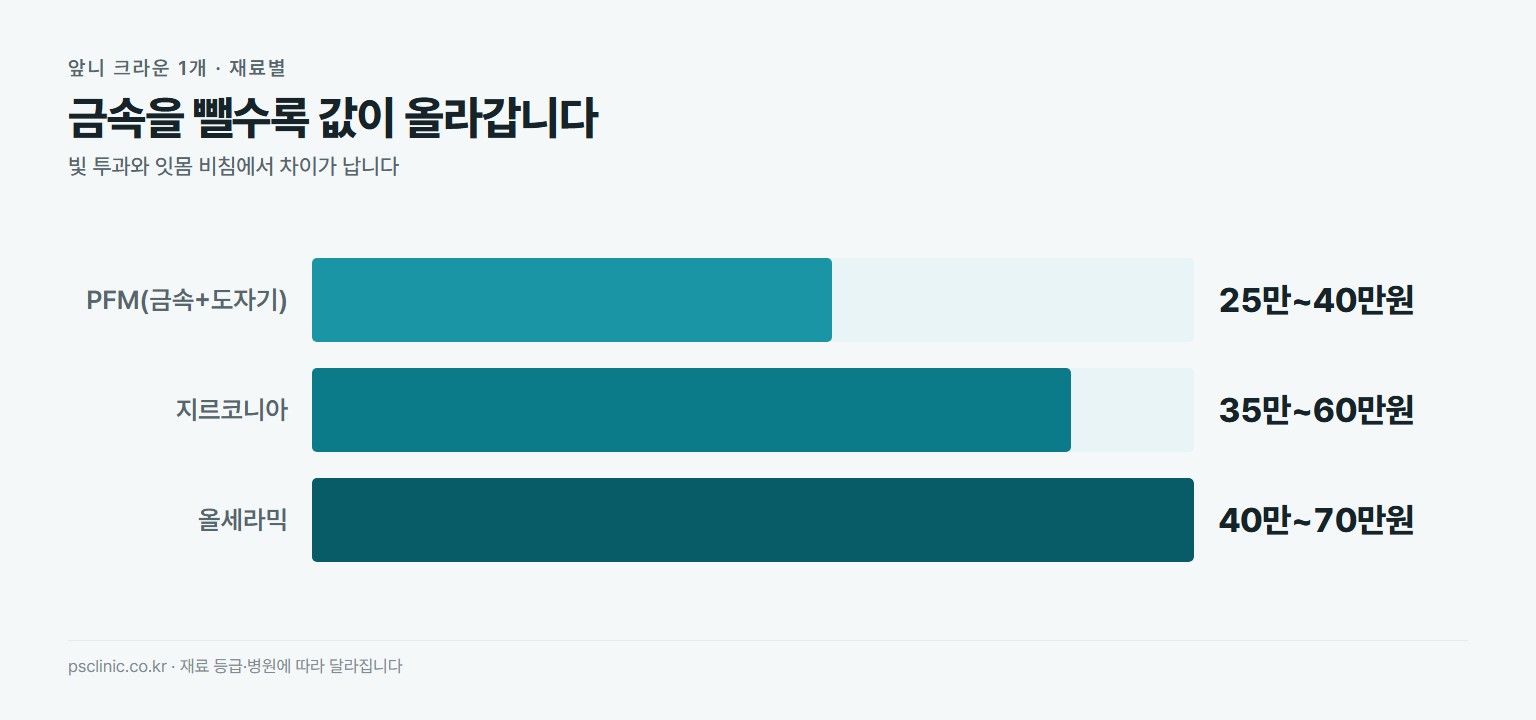 앞니 크라운 재료별 1개 가격 비교. PFM 금속과 도자기 약 25만~40만원, 지르코니아 약 35만~60만원, 올세라믹 약 40만~70만원