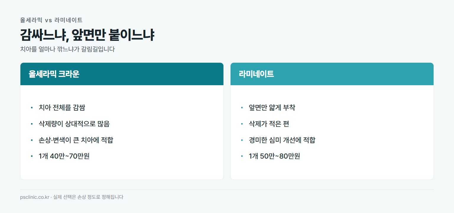 올세라믹 크라운과 라미네이트 비교. 올세라믹은 치아 전체를 감싸고 삭제량이 상대적으로 많으며 손상과 변색이 큰 치아에 적합하고 40만~70만원. 라미네이트는 앞면만 얇게 부착하고 삭제가 적으며 경미한 심미 개선에 적합하고 50만~80만원