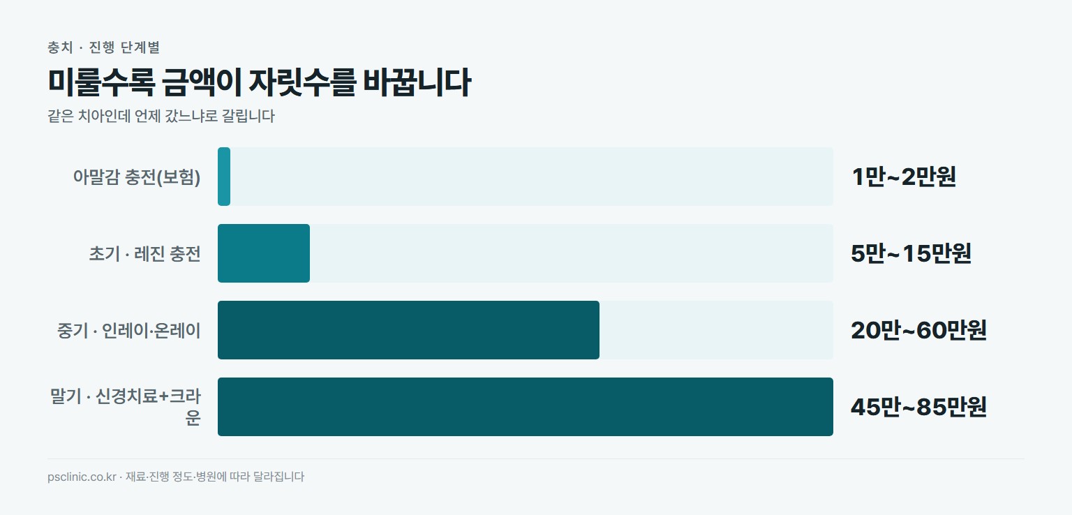 충치 치료 단계별 비용 비교. 아말감 충전 보험 약 1만~2만원, 초기 레진 충전 약 5만~15만원, 중기 인레이 온레이 약 20만~60만원, 말기 신경치료와 크라운 약 45만~85만원