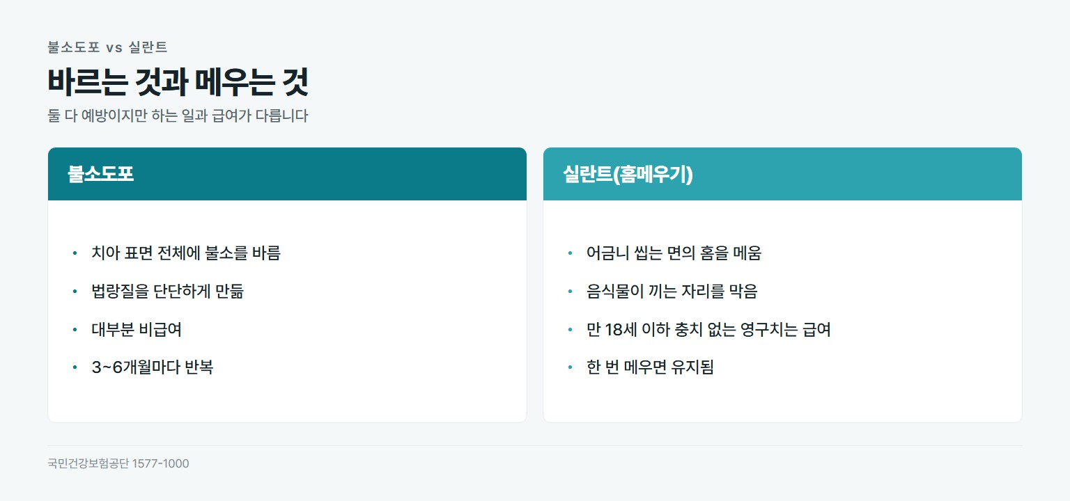 불소도포와 실란트 비교. 불소도포는 치아 표면 전체에 불소를 발라 법랑질을 강화하고 대부분 비급여이며 3~6개월마다 반복하고 치과 평균 약 7500원. 실란트는 어금니 씹는 면의 홈을 메워 충치를 막고 만 18세 이하 충치 없는 영구치는 급여이며 한 번 메우면 유지되고 급여 시 1치 수천 원에서 1만 원