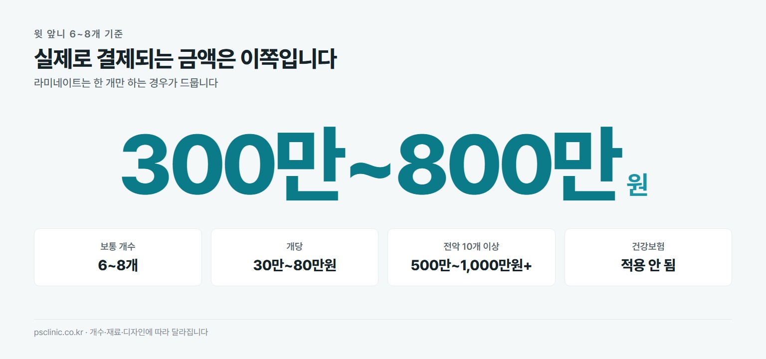 앞니 라미네이트 전체 총비용 약 300만~800만원. 보통 개수 6~8개, 개당 30만~80만원, 전악 10개 이상은 500만~1000만원 이상, 건강보험 미적용