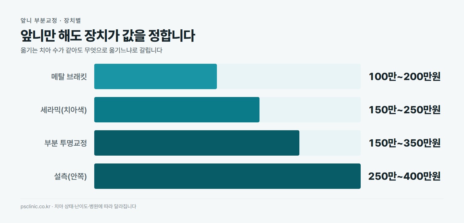 앞니 부분교정 장치별 비용 비교. 메탈 브래킷 약 100만~200만원, 세라믹 치아색 약 150만~250만원, 부분 투명교정 약 150만~350만원, 설측 안쪽 약 250만~400만원