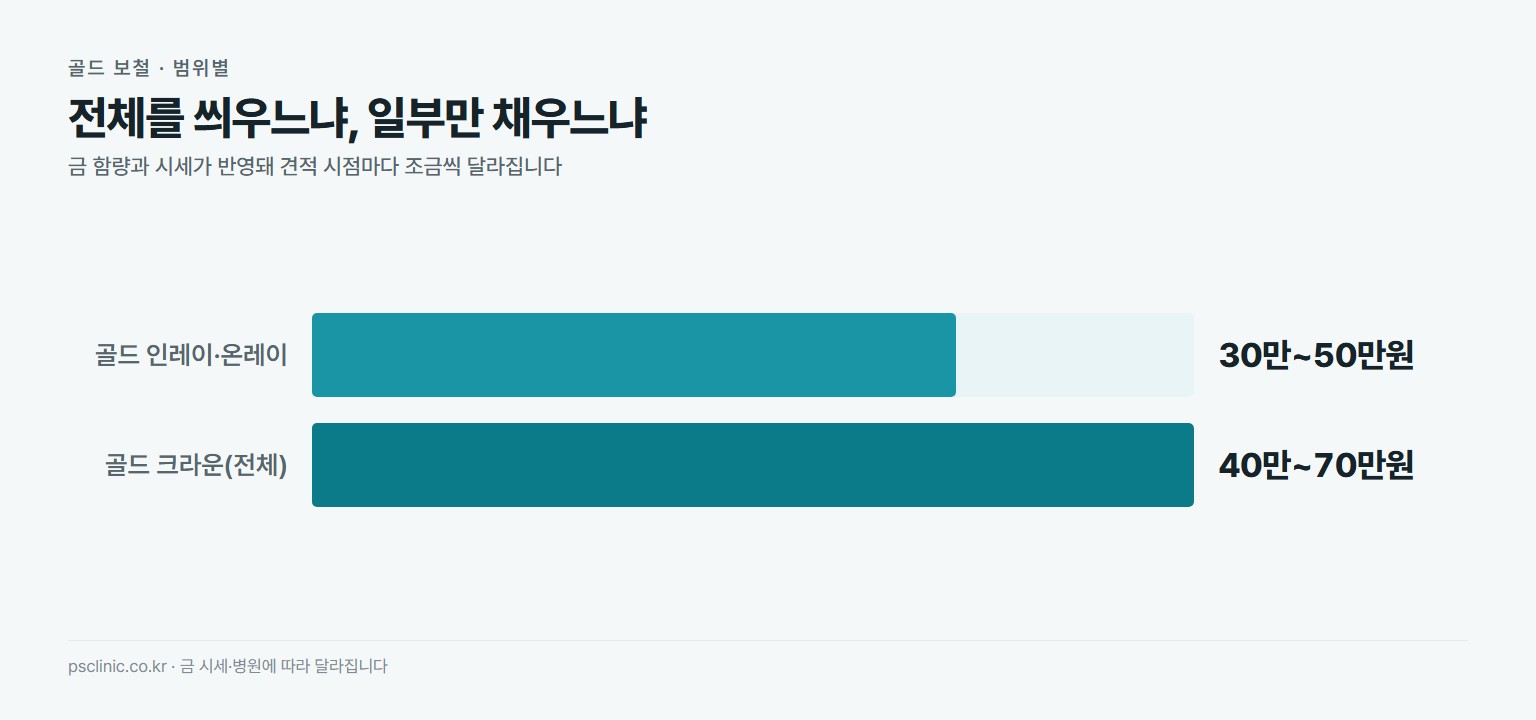 골드 보철 비용 비교. 골드 인레이와 온레이 부분 수복 약 30만~50만원, 골드 크라운 전체 약 40만~70만원