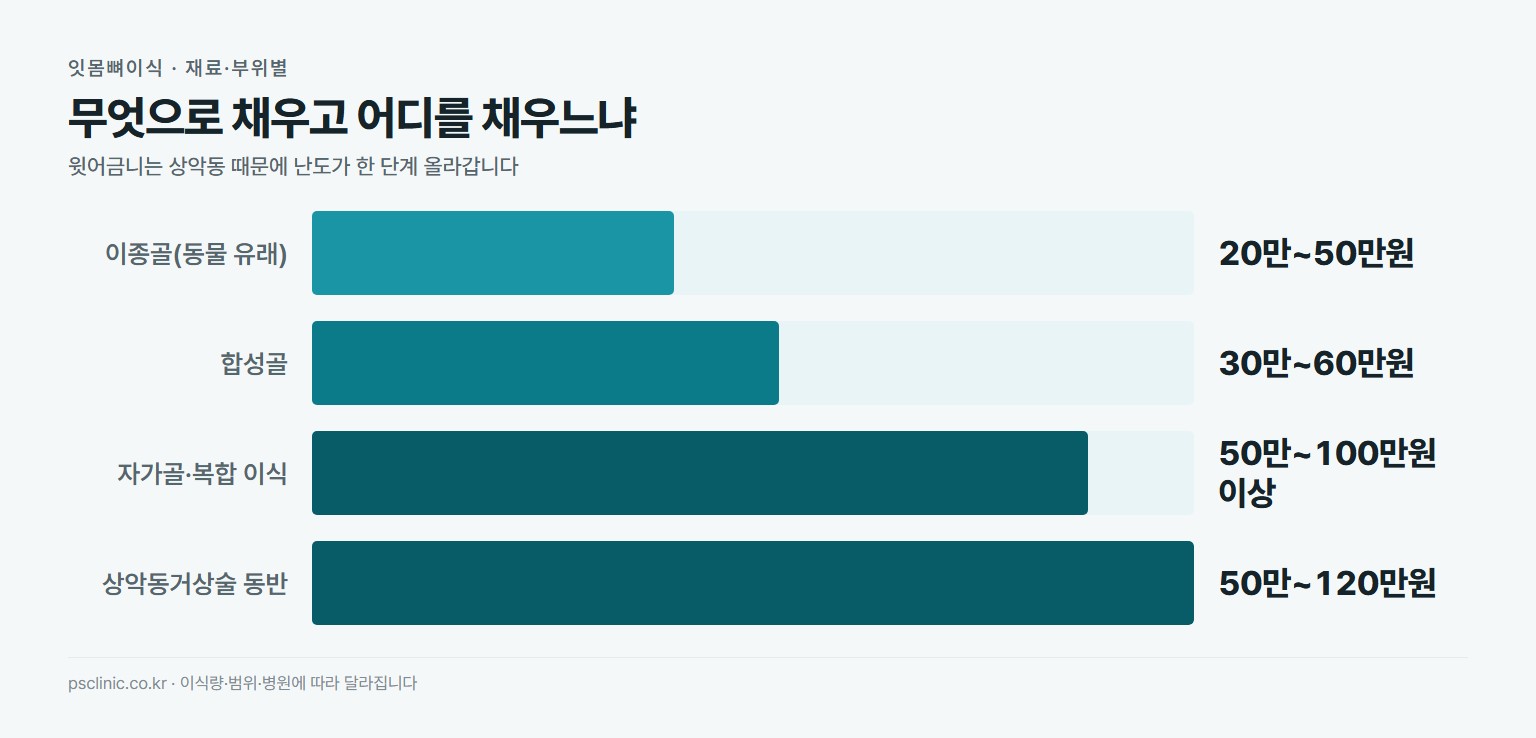 잇몸뼈이식 재료별 비용 비교. 이종골 동물 유래 약 20만~50만원, 합성골 인공 재료 약 30만~60만원, 자가골과 복합 이식 약 50만~100만원 이상, 상악동거상술 동반 약 50만~120만원