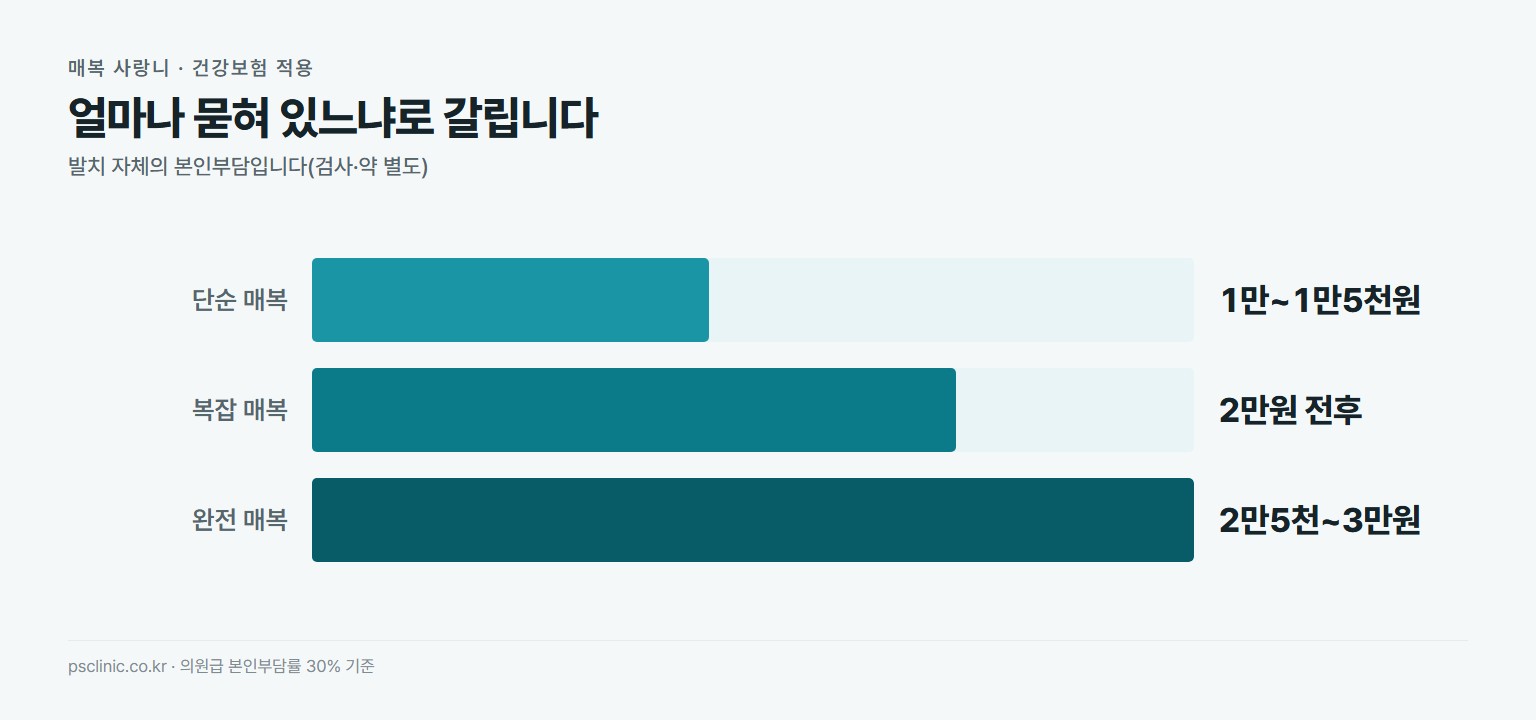 매복 사랑니 발치 본인부담 비교. 단순 매복 약 1만~1만5천원, 복잡 매복 약 2만원 전후, 완전 매복 약 2만5천~3만원