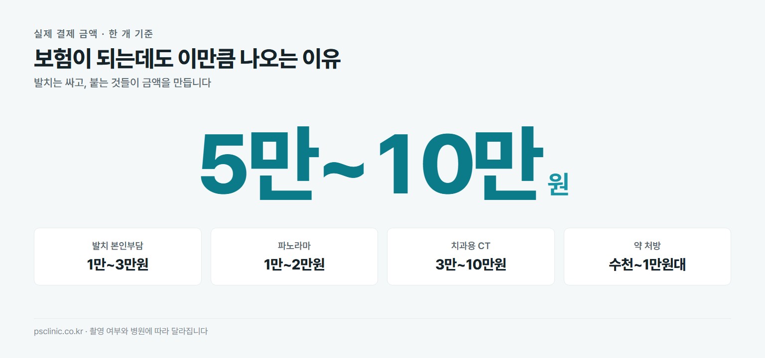매복 사랑니 발치 실제 총비용 약 5만~10만원. 발치 본인부담 1만~3만원, 파노라마 1만~2만원, 치과용 CT 3만~10만원, 약 처방 수천원에서 1만원대