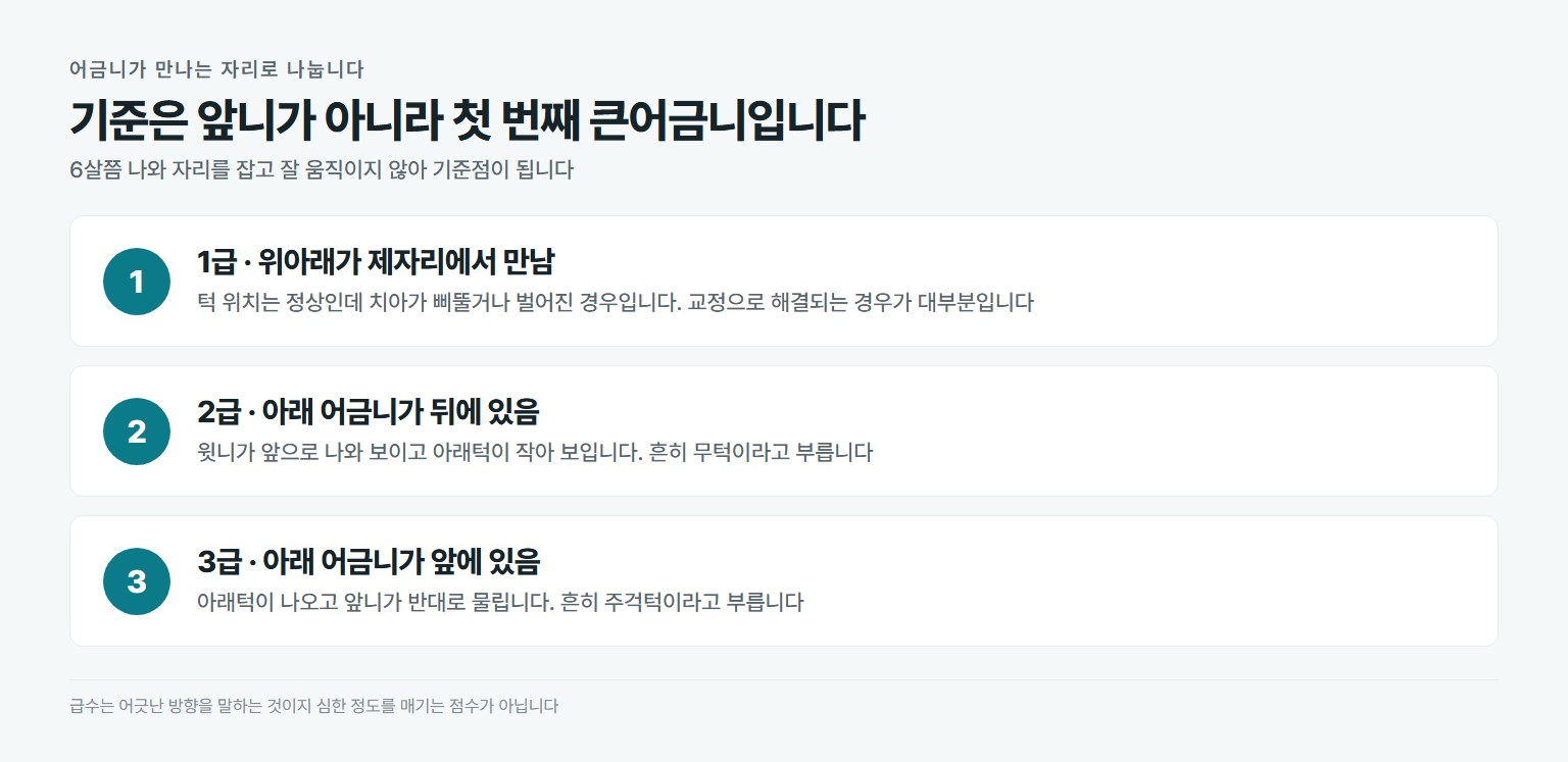 부정교합 1급 2급 3급을 어금니가 만나는 위치로 나눈 설명 도표