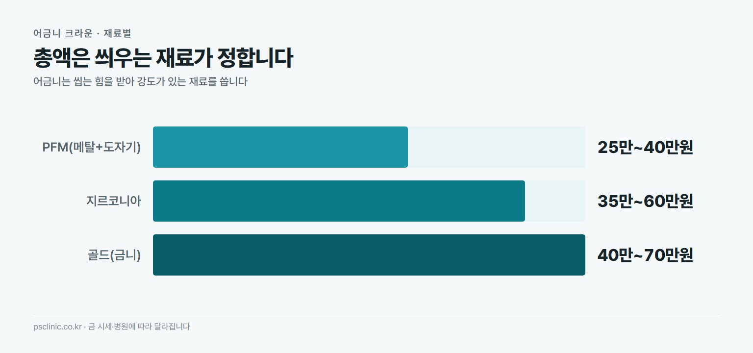어금니 크라운 재료별 비용 비교. PFM 메탈과 도자기 약 25만~40만원, 지르코니아 약 35만~60만원, 골드 금니 약 40만~70만원