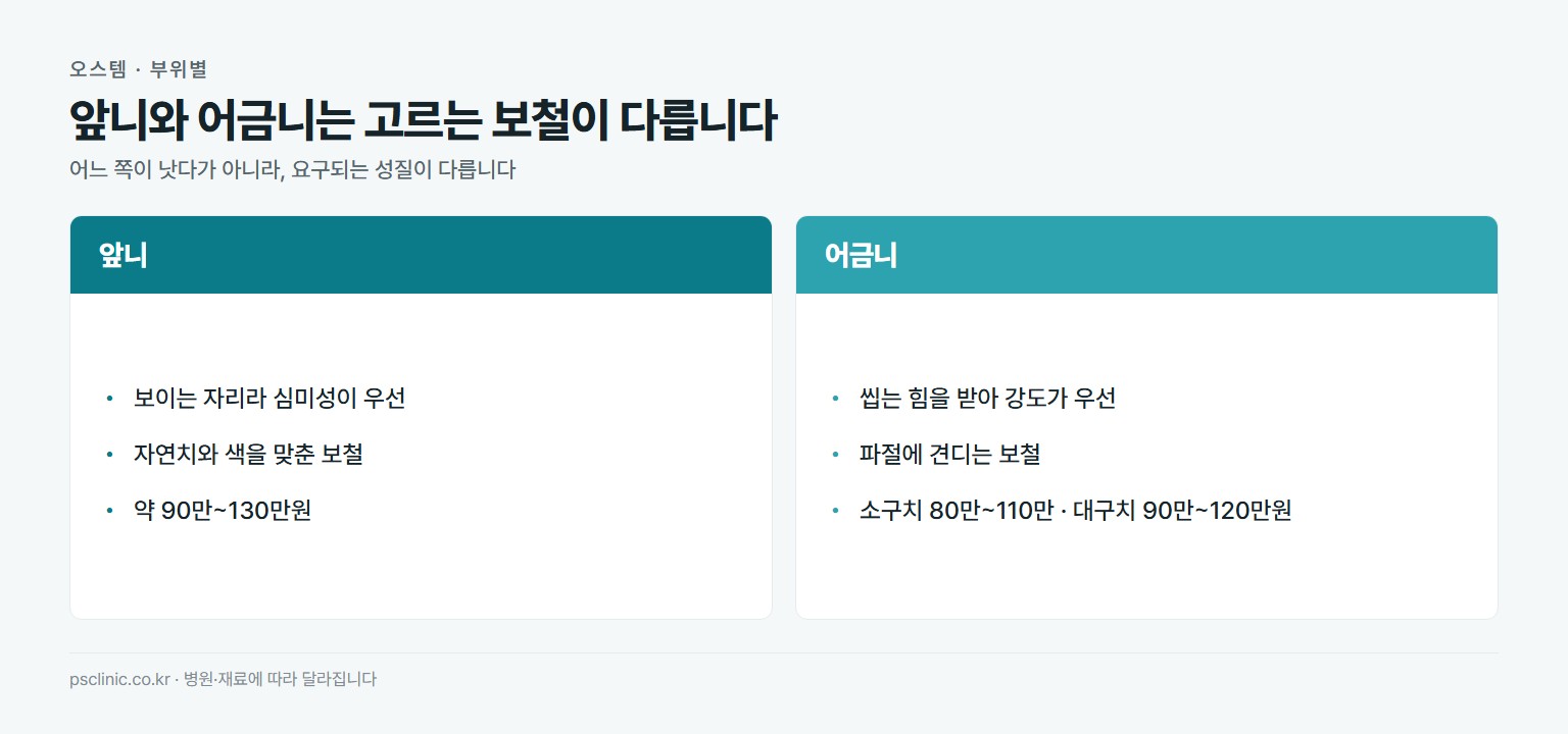 오스템 임플란트 부위별 비교. 앞니는 심미성 우선 자연색 보철 약 90만~130만원, 어금니는 저작압이 커 강도 보철 선호 소구치 80만~110만원 대구치 90만~120만원