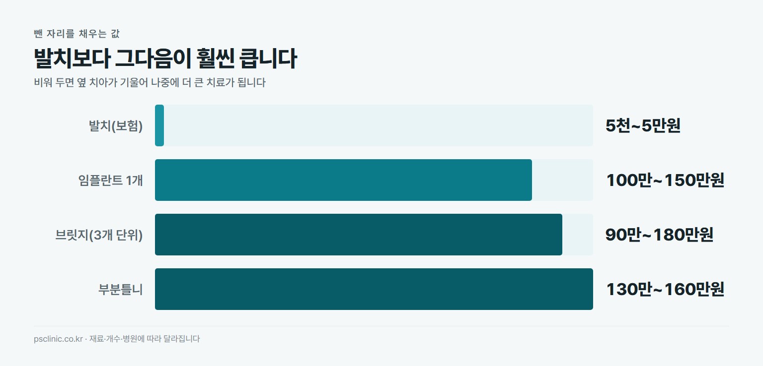 발치와 이후 보철 비용 비교. 발치 본인부담 5천~5만원, 임플란트 1개 100만~150만원, 브릿지 3개 단위 90만~180만원, 부분틀니 130만~160만원