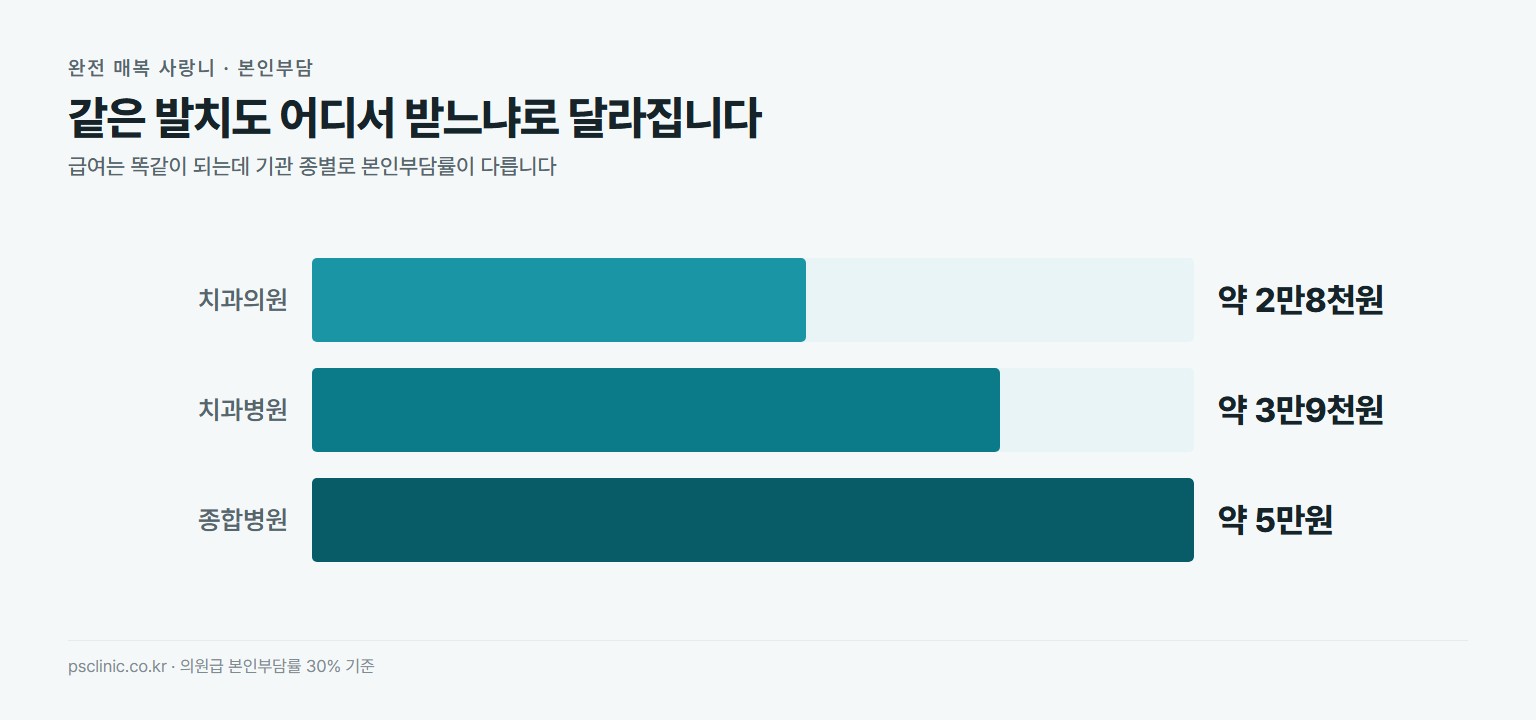 완전 매복 사랑니 발치 본인부담 기관별 비교. 치과의원 약 2만8천원, 치과병원 약 3만9천원, 종합병원 약 5만원