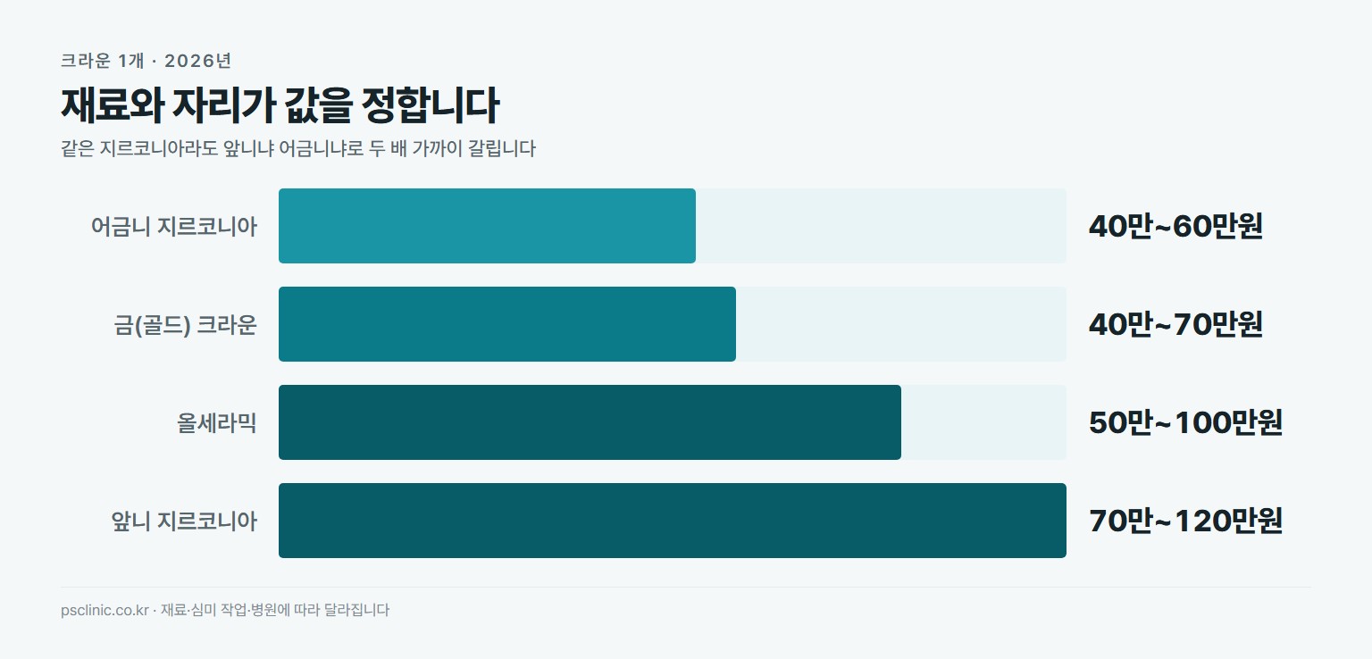 크라운 재료별 1개 가격 비교. 어금니 지르코니아 40만~60만원, 금 크라운 40만~70만원, 올세라믹 50만~100만원, 앞니 지르코니아 70만~120만원